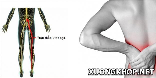 Bạn nên tham khảo trước giá lắp đặt trên thị trường và đo chính xác số đo rèm cửa để có được những quyết định đúng đắn
